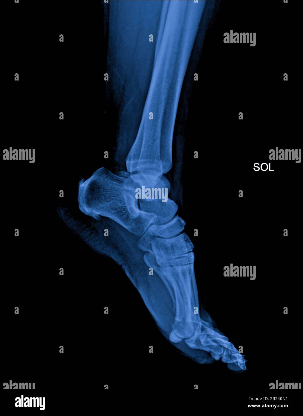 Xray normal human's foot lateral Stock Photo Alamy