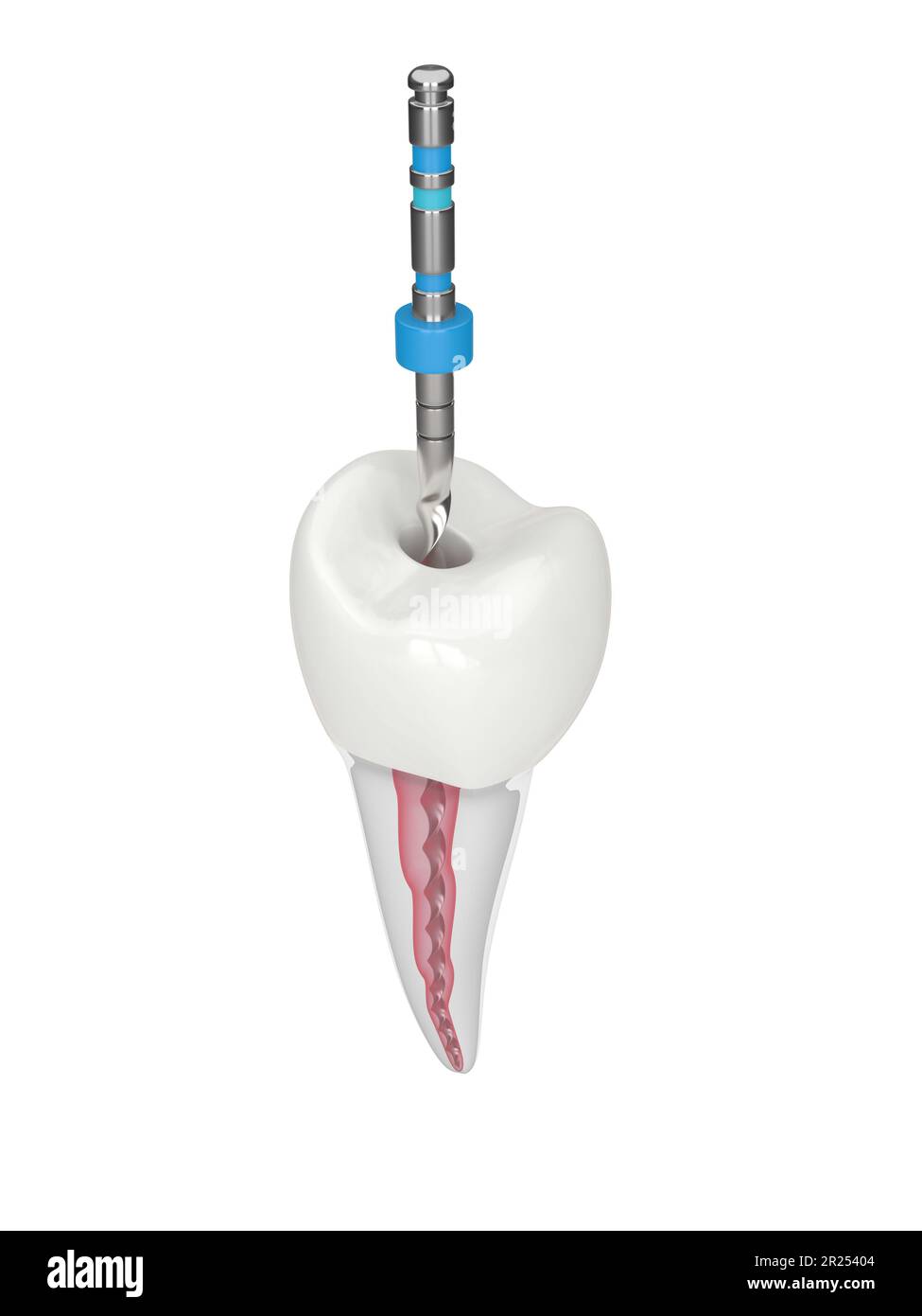 3d render of premolar tooth with endodontic rotary file over white