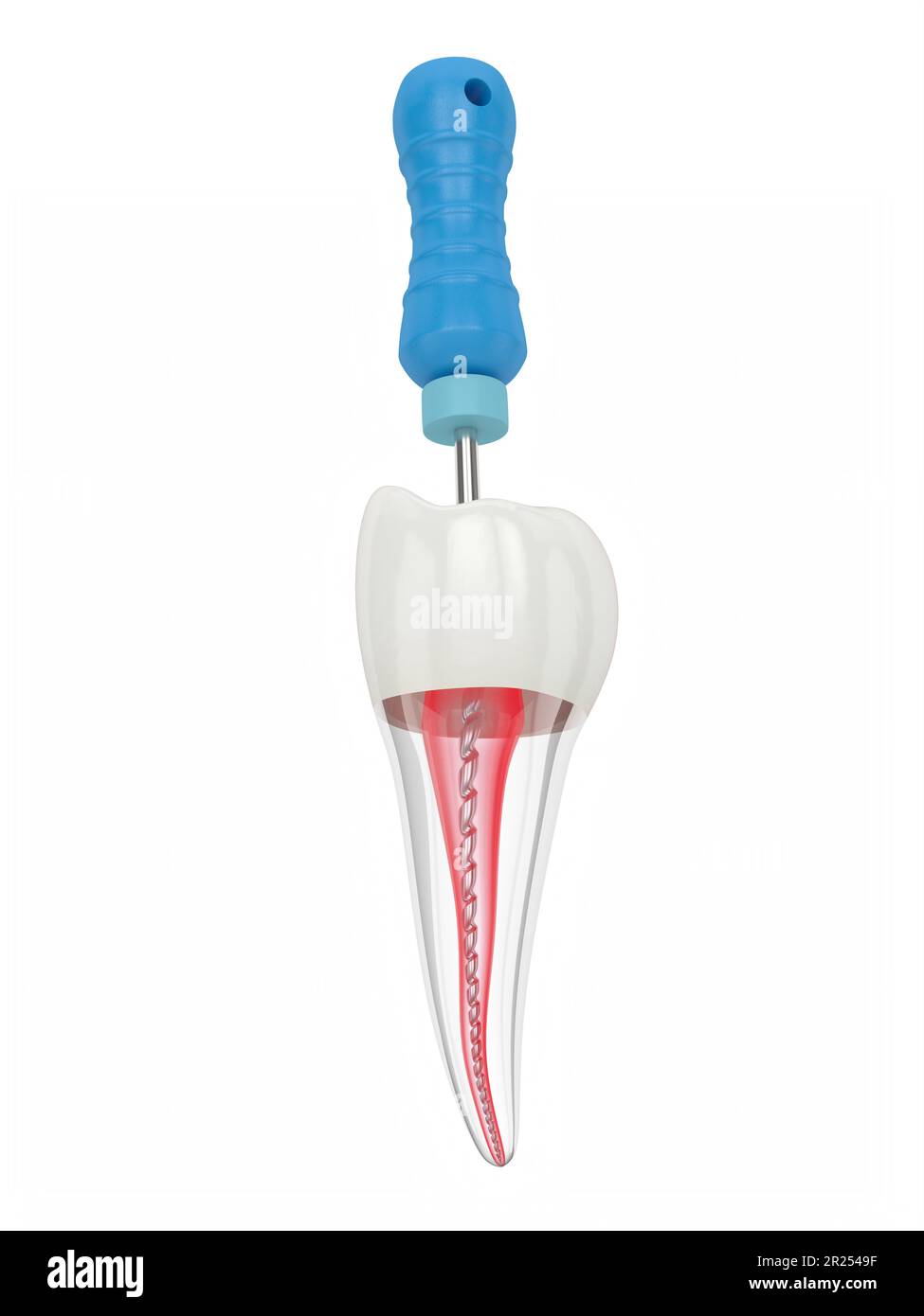 3d render of premolar tooth with endodontic C file over white