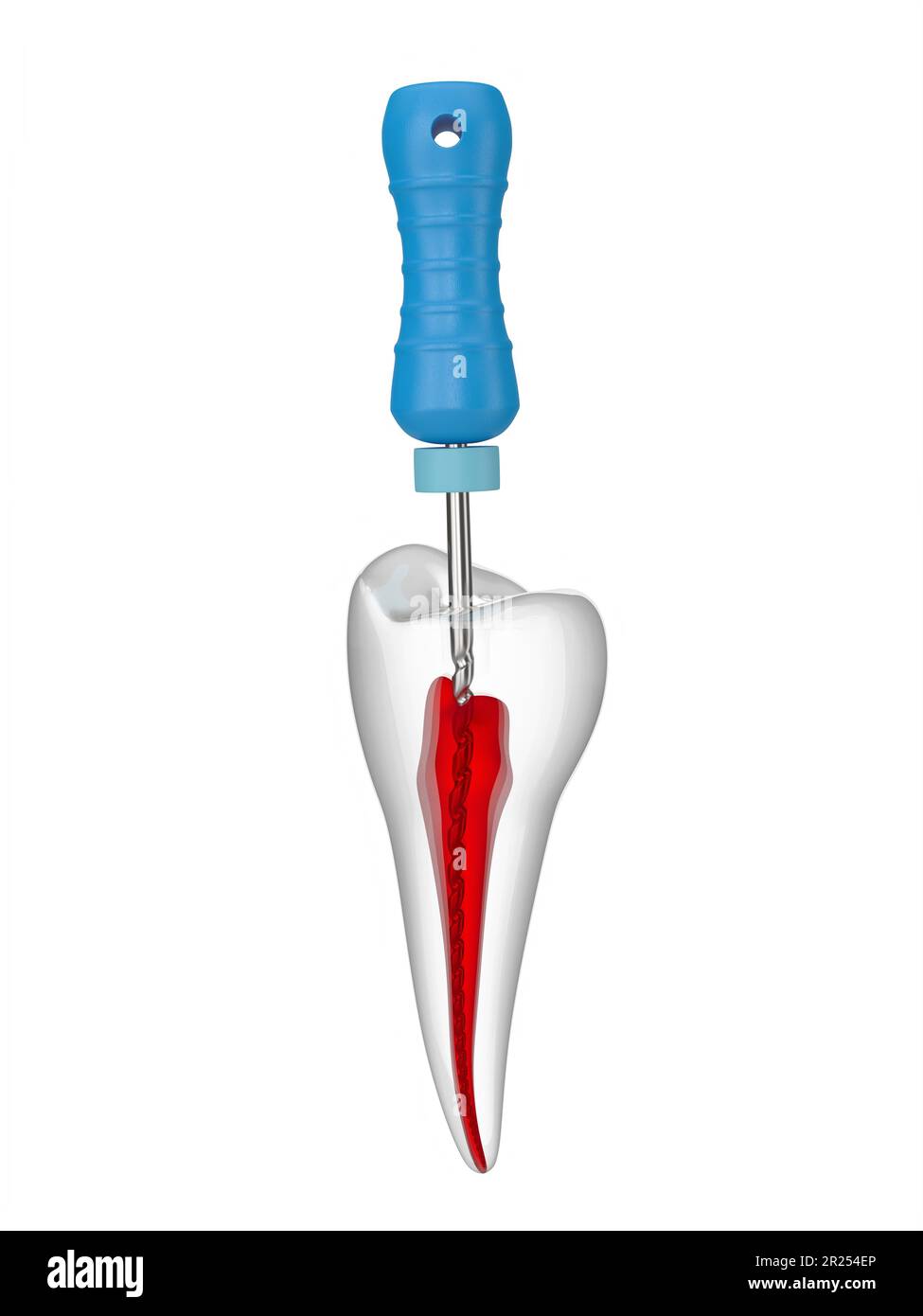 3d render of premolar tooth with endodontic C file over white