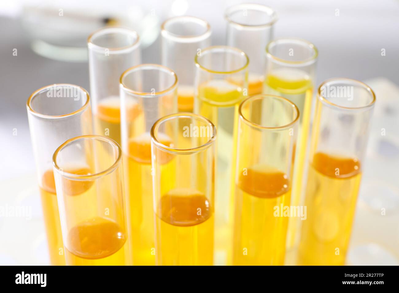 Tubes with urine samples for analysis on blurred background, closeup ...
