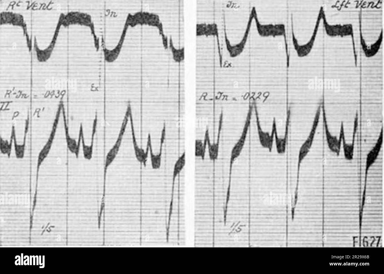 "The Excitatory Process in the Dog's Heart. Part II. The Ventricles