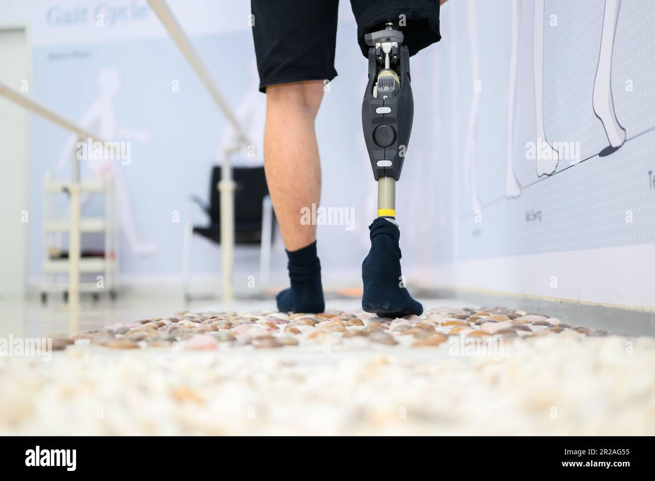 Disabled athlete patient with physical disability doing exercise Stock