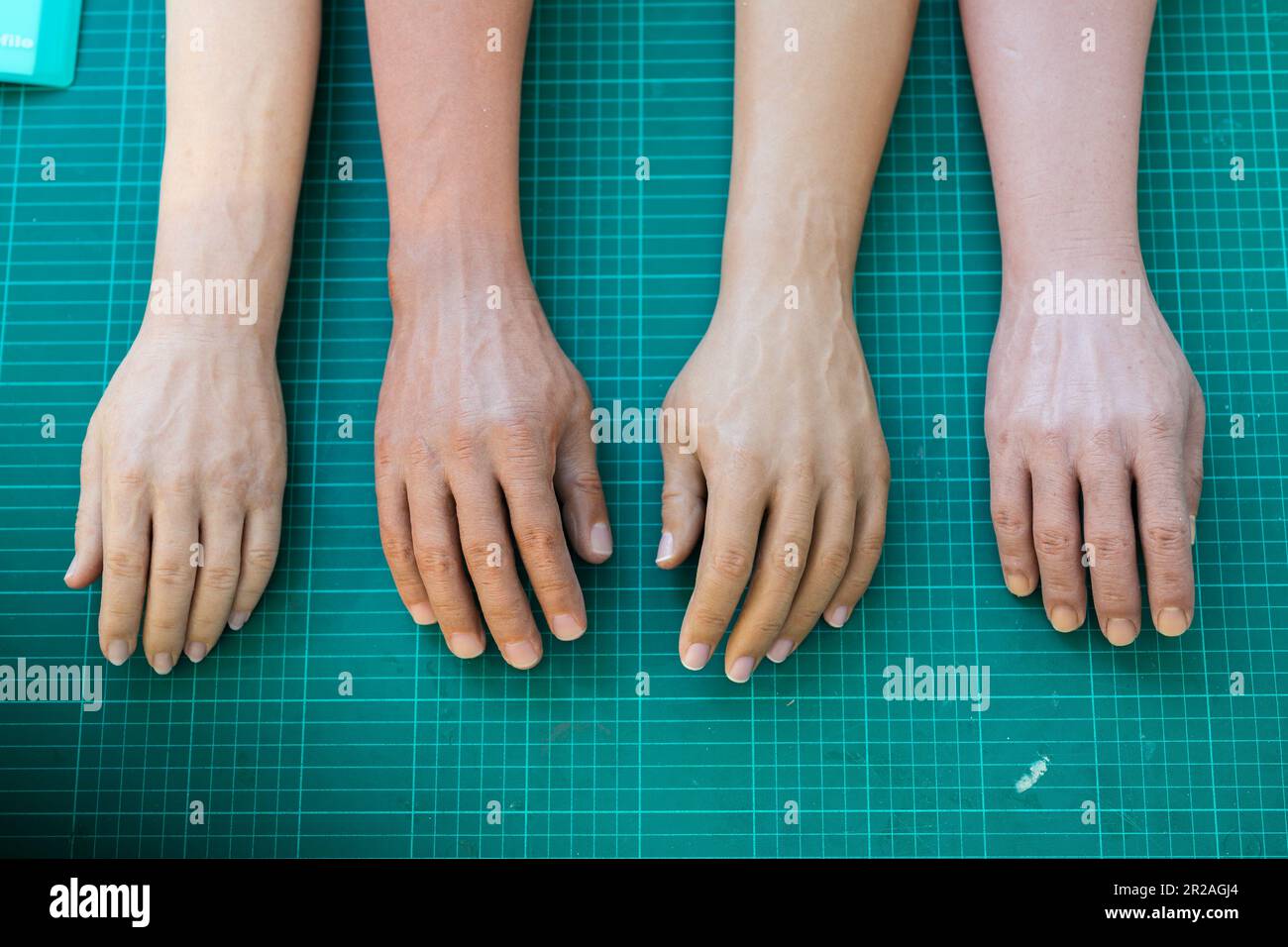 Parts of artificial silicon arms prosthetic in prosthetic