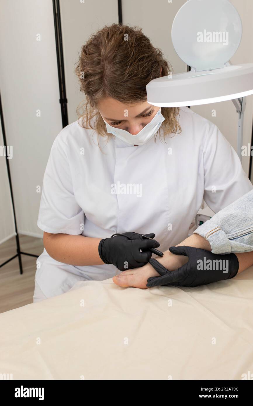 Trained Professional Remove Hair On Woman's Toes, Foot With Hair