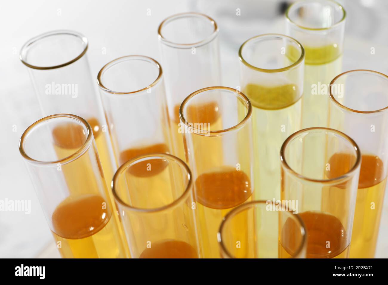 Tubes with urine samples for analysis on blurred background, closeup ...
