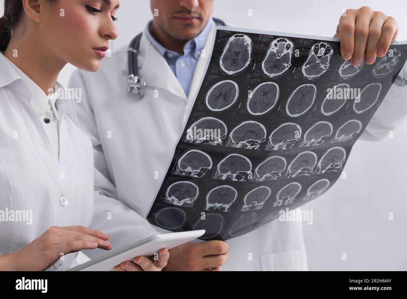 Doctors examining MRI images of patient with multiple sclerosis in clinic, closeup Stock Photo