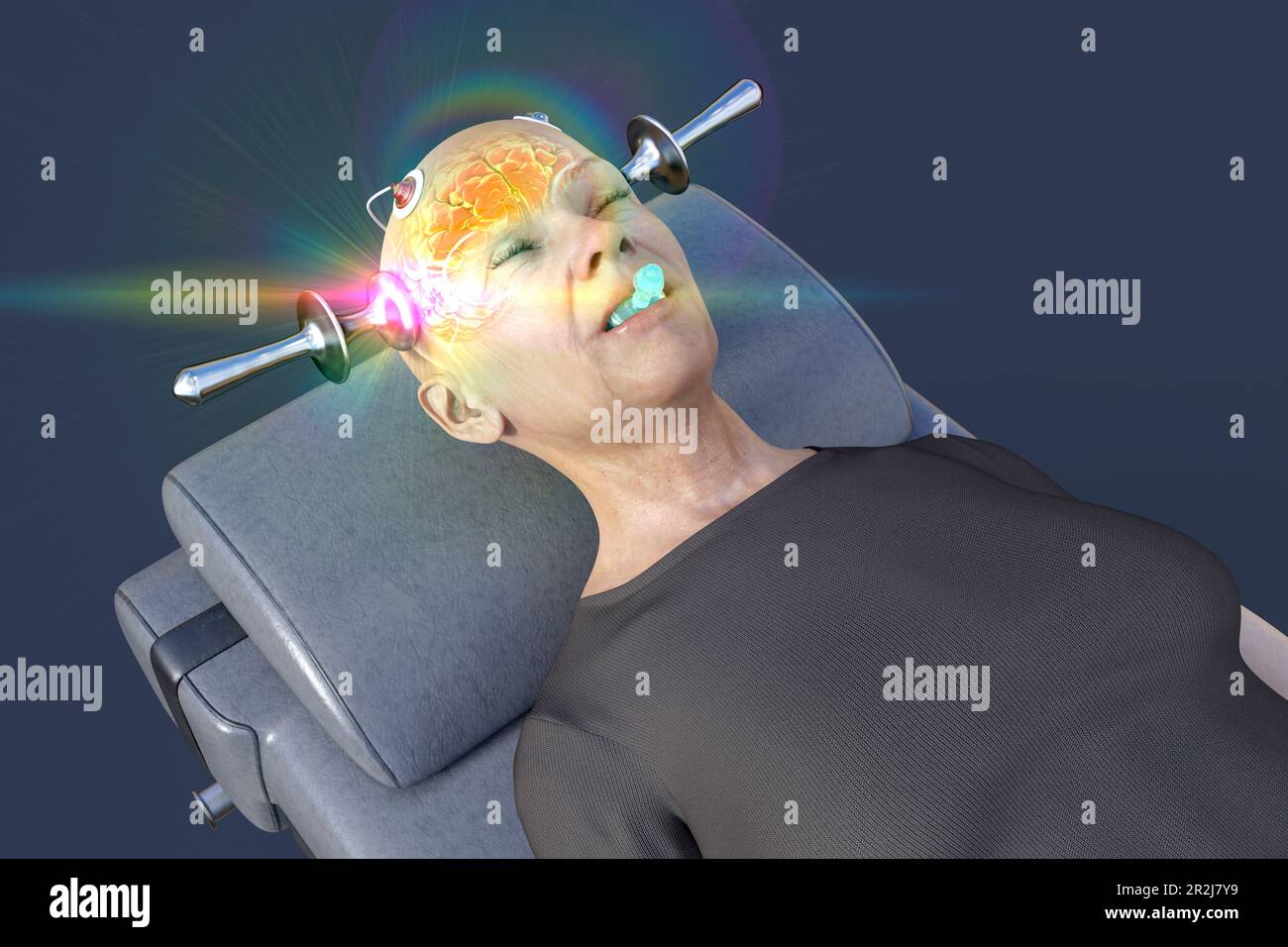 Electroconvulsive therapy machine hi-res stock photography and images -  Alamy