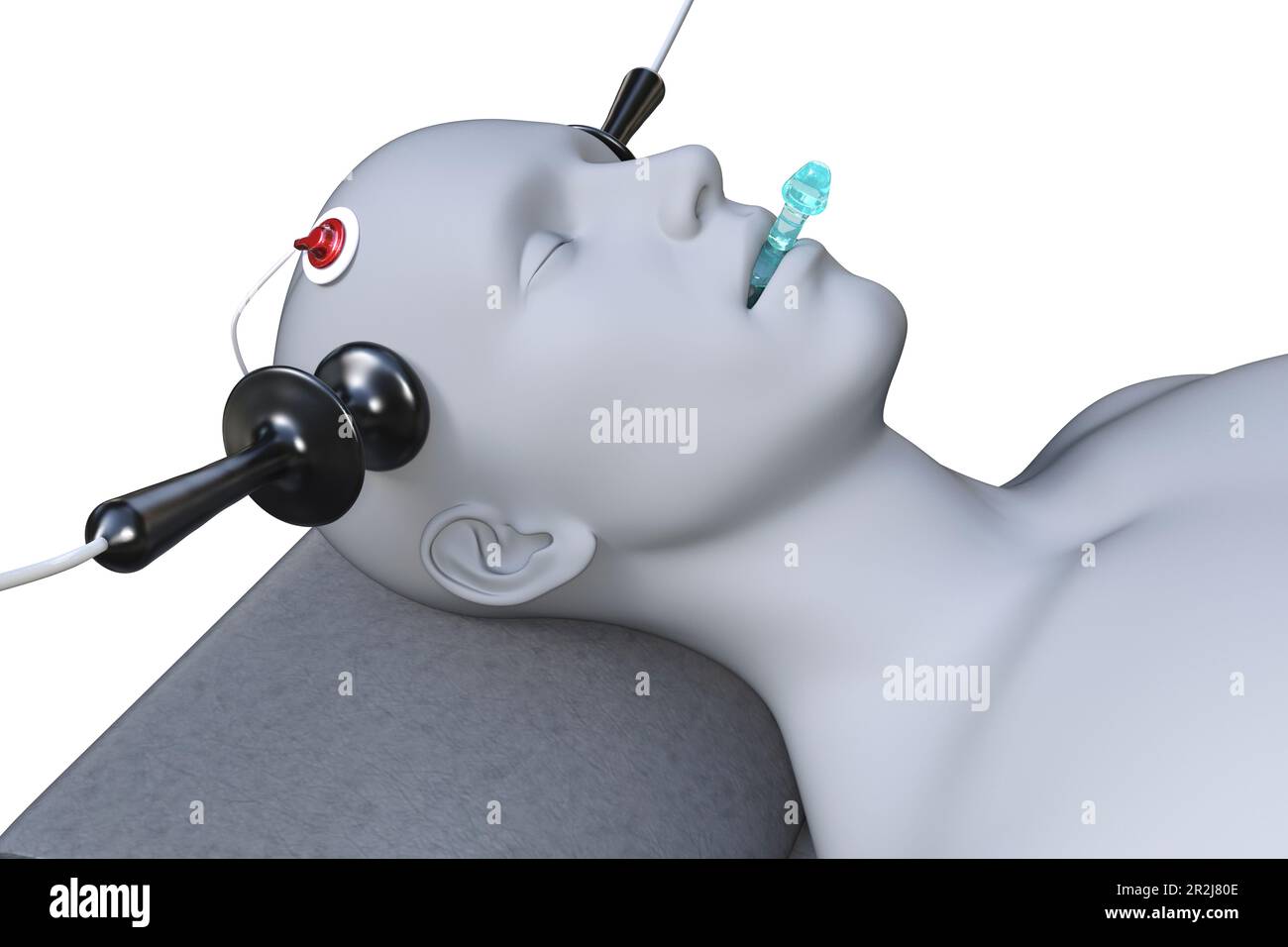 Electroconvulsive therapy machine hi-res stock photography and images -  Alamy