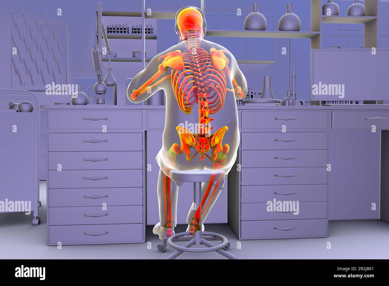 Musculoskeletal disorders in lab workers, illustration Stock Photo Alamy