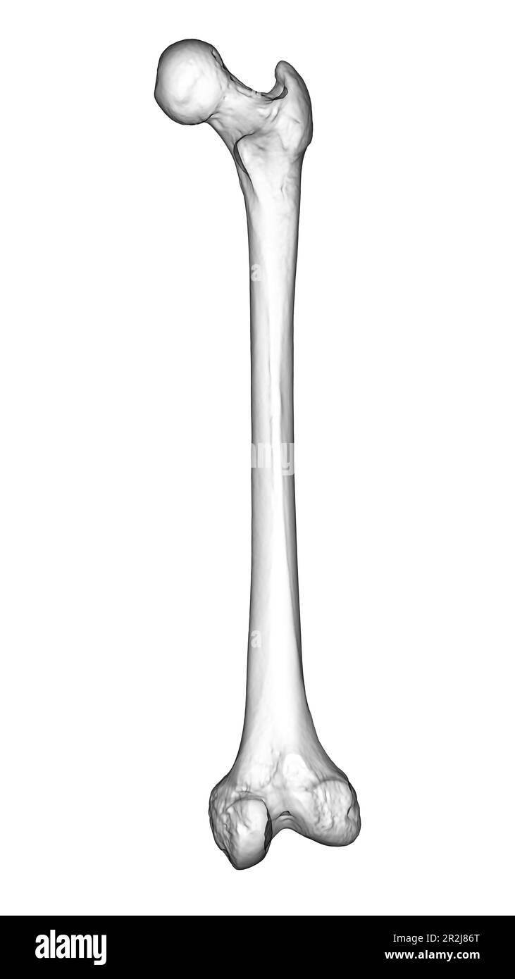 Computer illustration of a femur (thigh bone), the largest bone in the