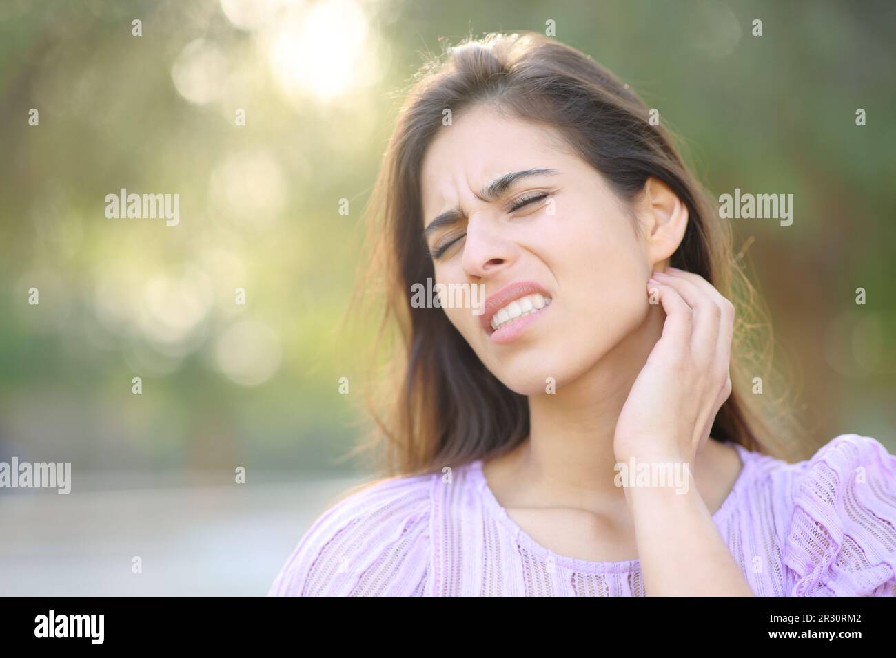 Stressed woman scratching neck after insect bite in a park Stock Photo