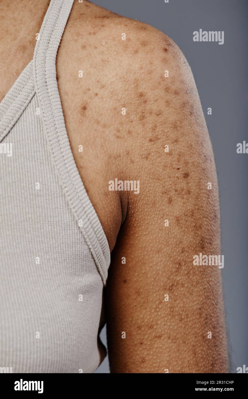 Closeup detail image of black young woman with real skin texture and
