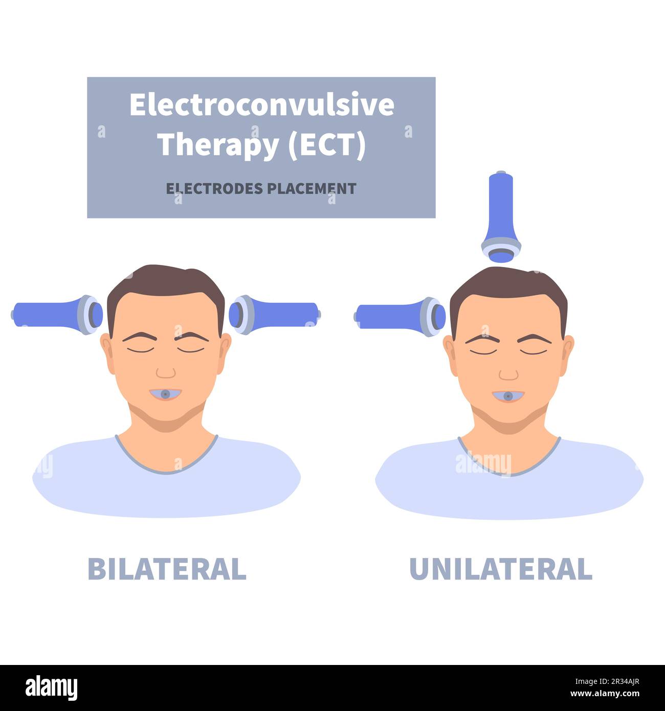Changing the image problem of electroconvulsive therapy