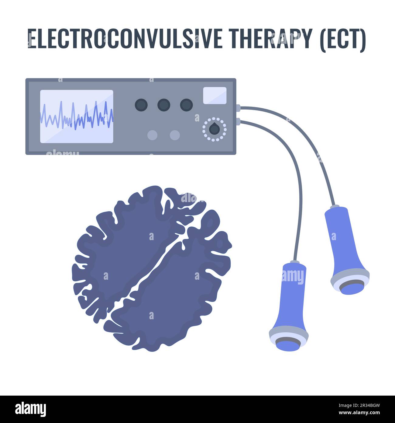 ECT electroconvulsive therapy for severe depression treatment Stock