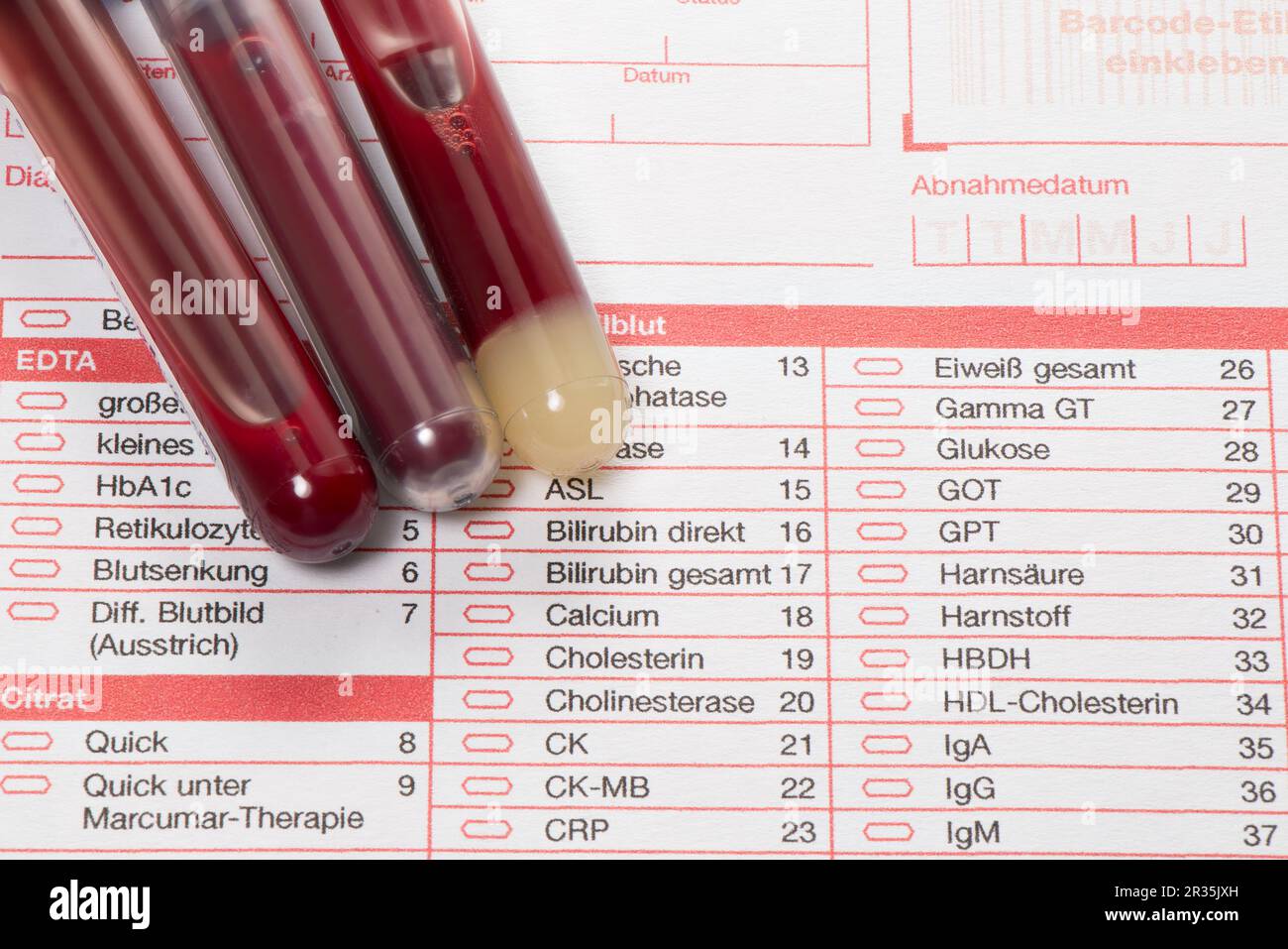 Blood test, blood samples on a laboratory form Stock Photo Alamy