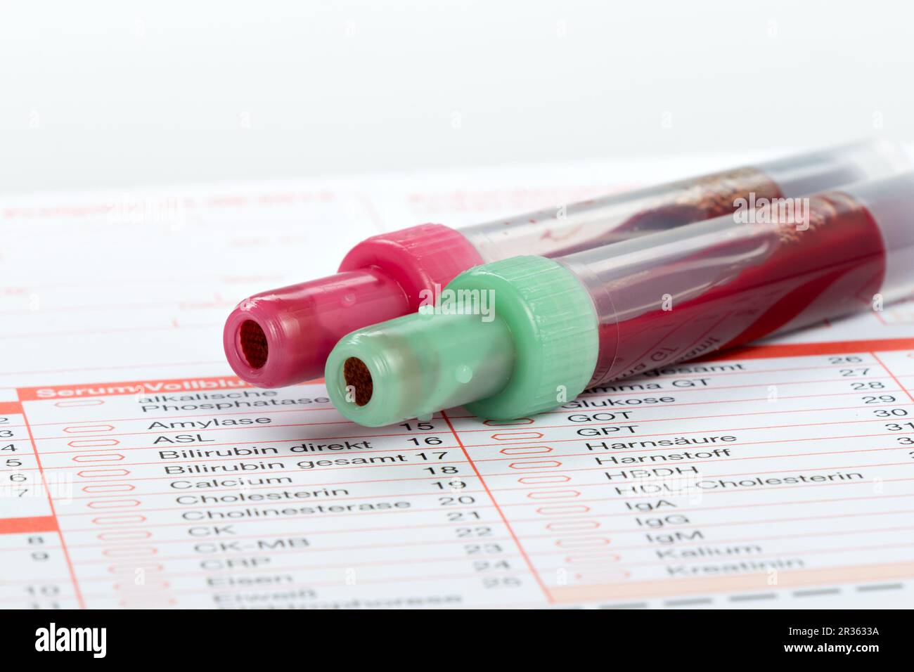 Blood test, blood samples on a laboratory form Stock Photo Alamy