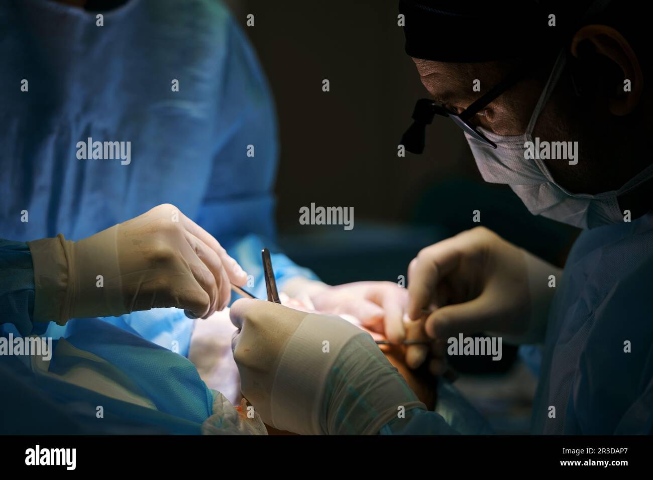 surgeon works in the operating room by the light of a lamp Stock Photo ...