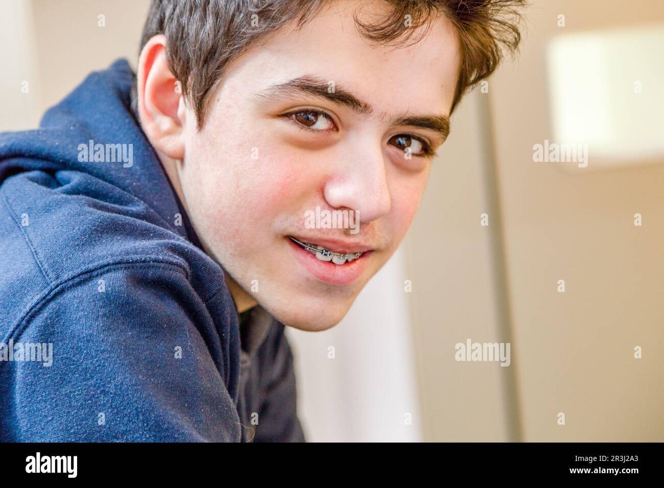 Boy smiling with braces Stock Photo Alamy