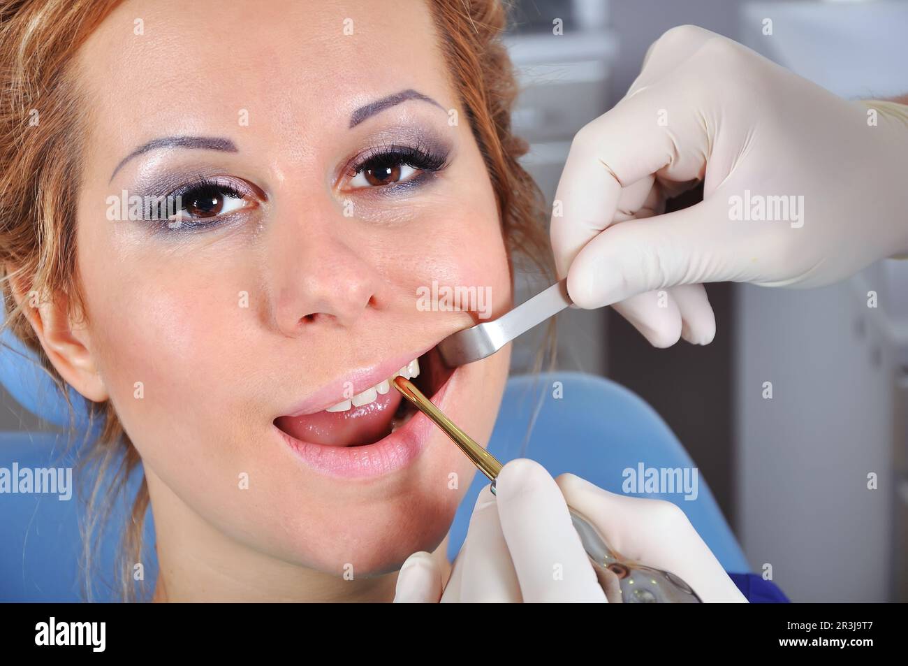 dentist removes the tooth beautiful girl Stock Photo Alamy