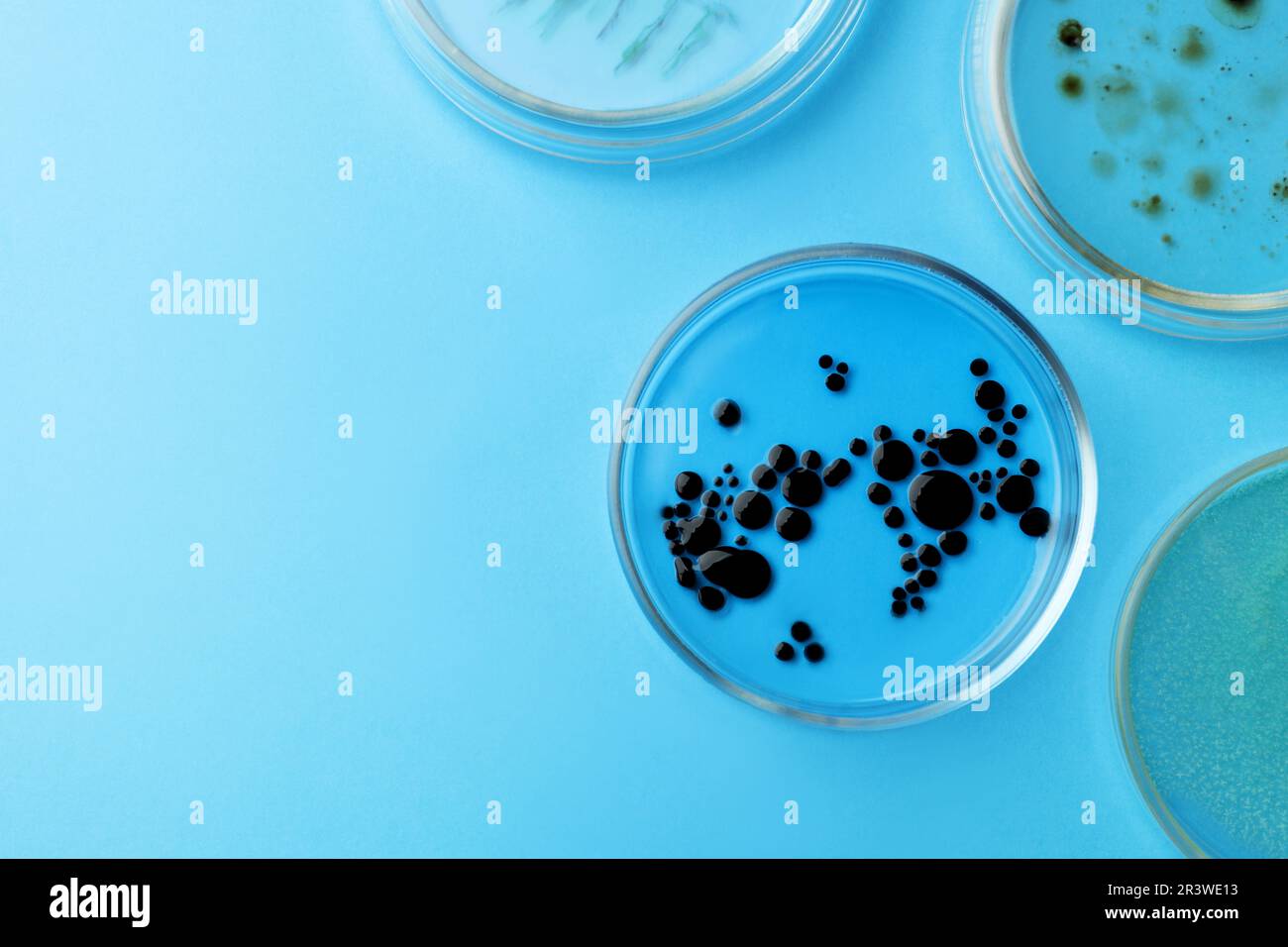Petri dishes with different bacteria colonies on light blue background ...