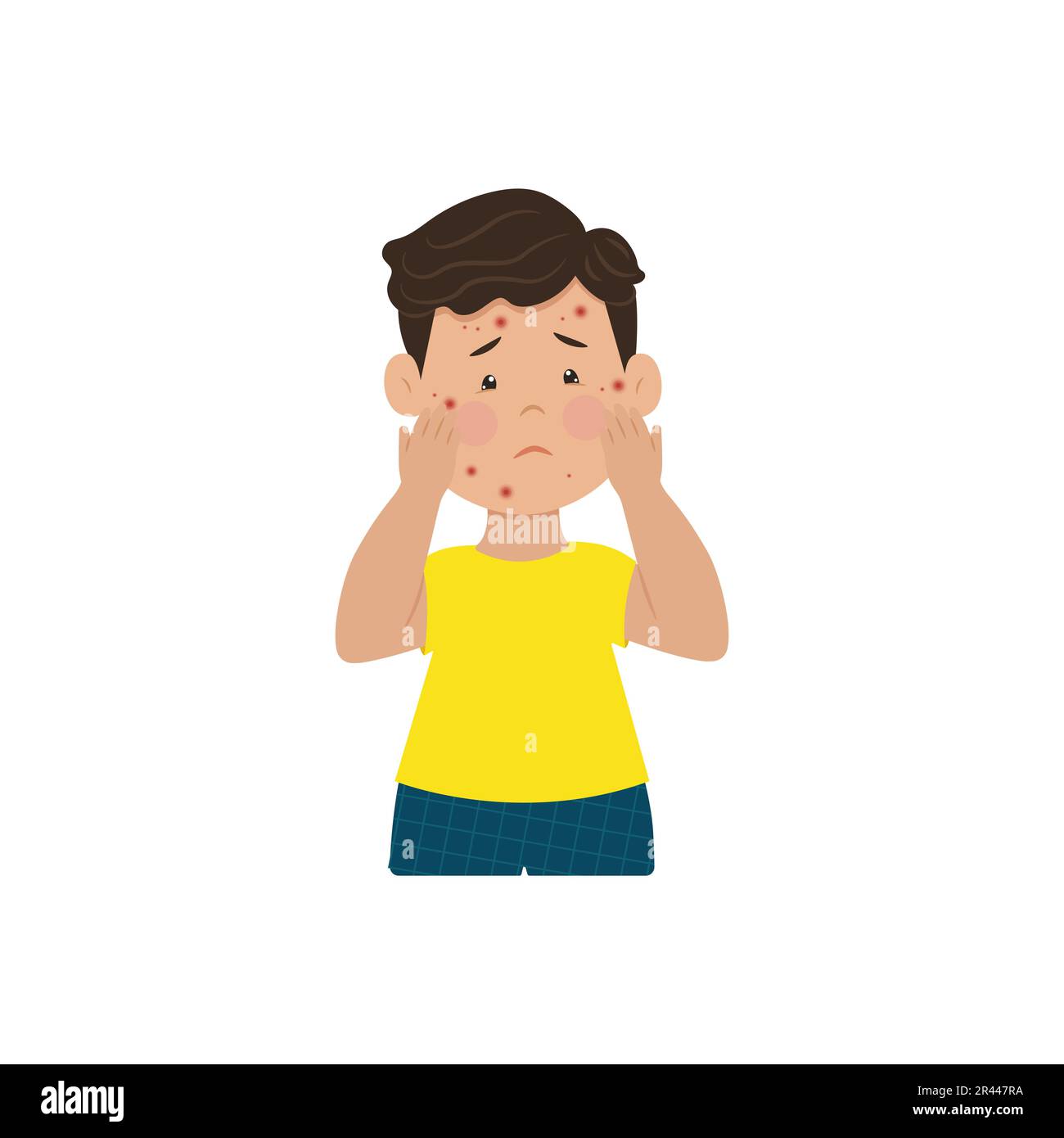 Allergy and infectious rashes on the face in children Vector