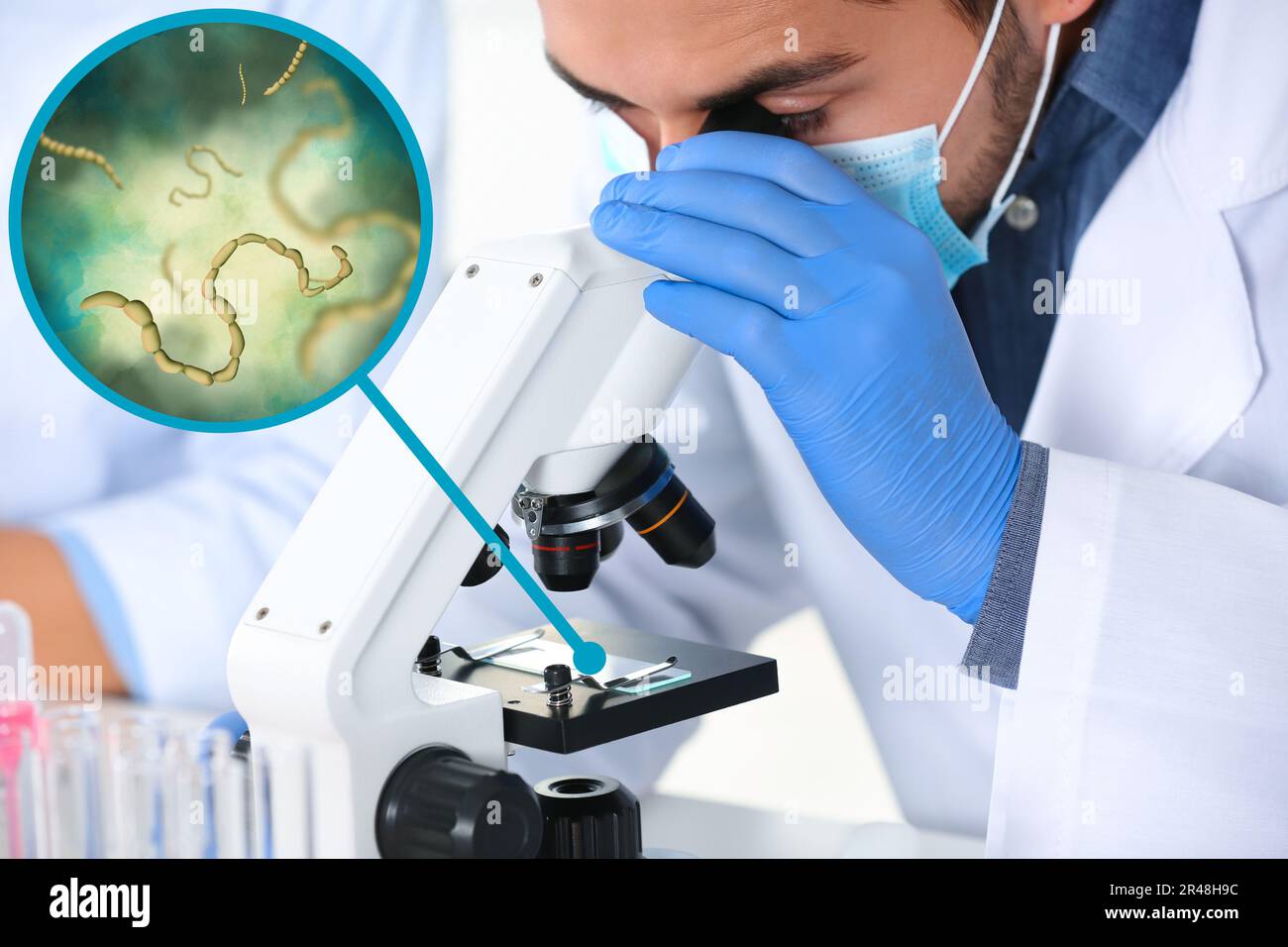 Parasitic worm microscope hi-res stock photography and images - Alamy