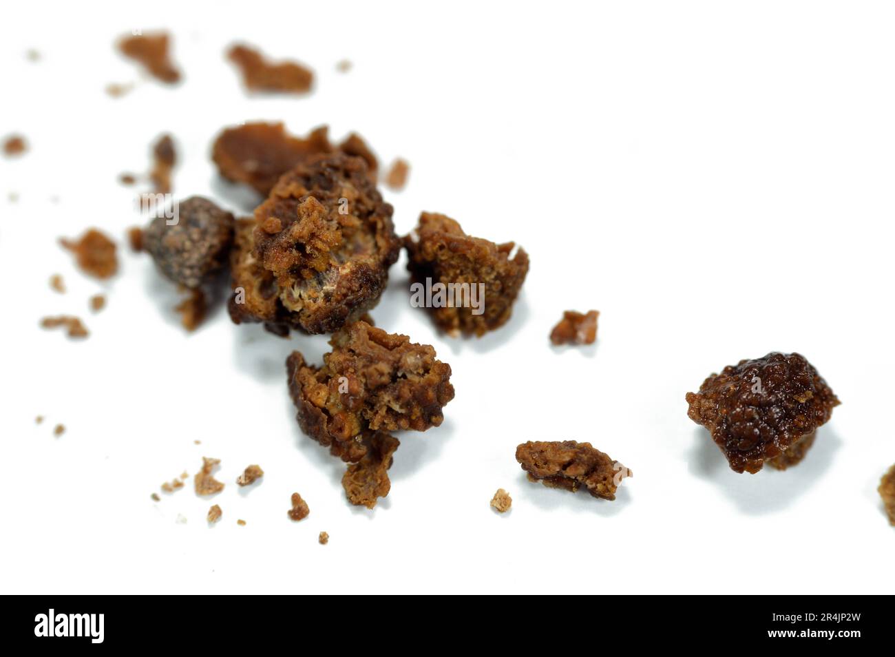 Nephrolithiasis, irregular brown kidney stones (renal calculus or nephrolith), the stones are different in size after operative ureteroscopy and Laser Stock Photo