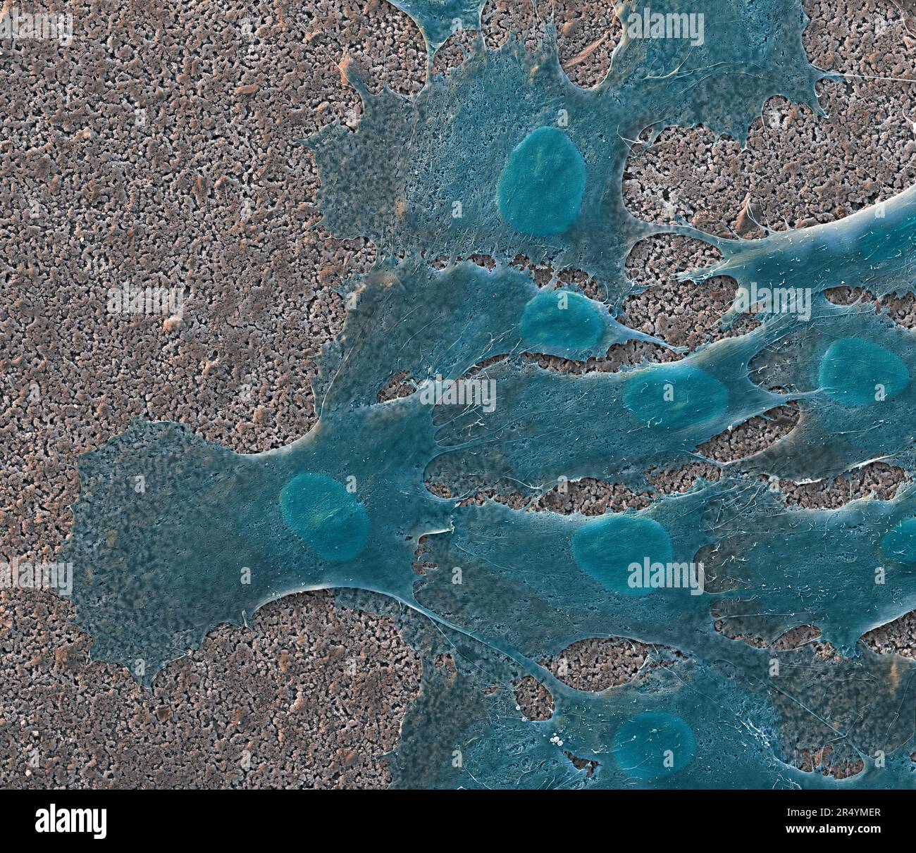 Coloured scanning electron micrograph (SEM) of a bioprinted bone ...