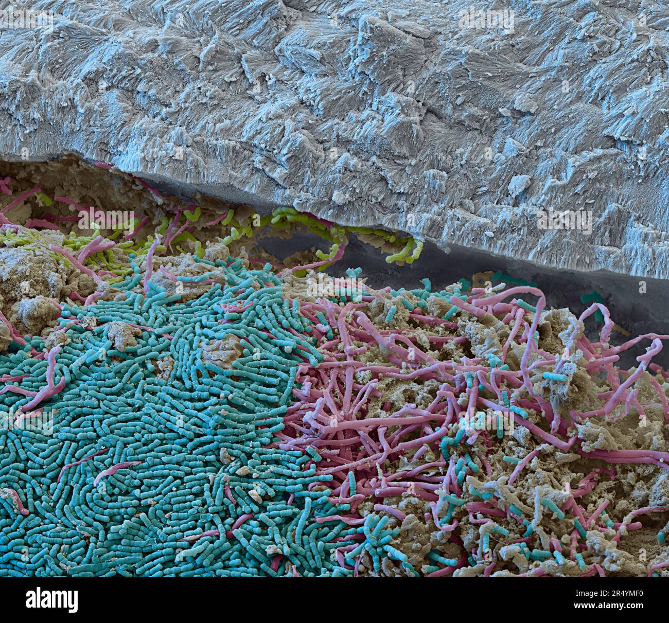 Coloured scanning electron micrograph (SEM) of a section through a