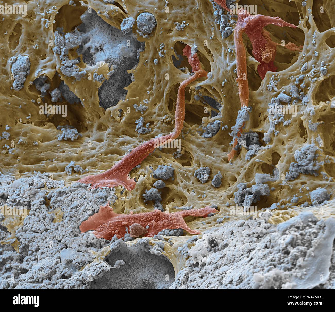 Coloured scanning electron micrograph (SEM) of a bioprinted bone ...