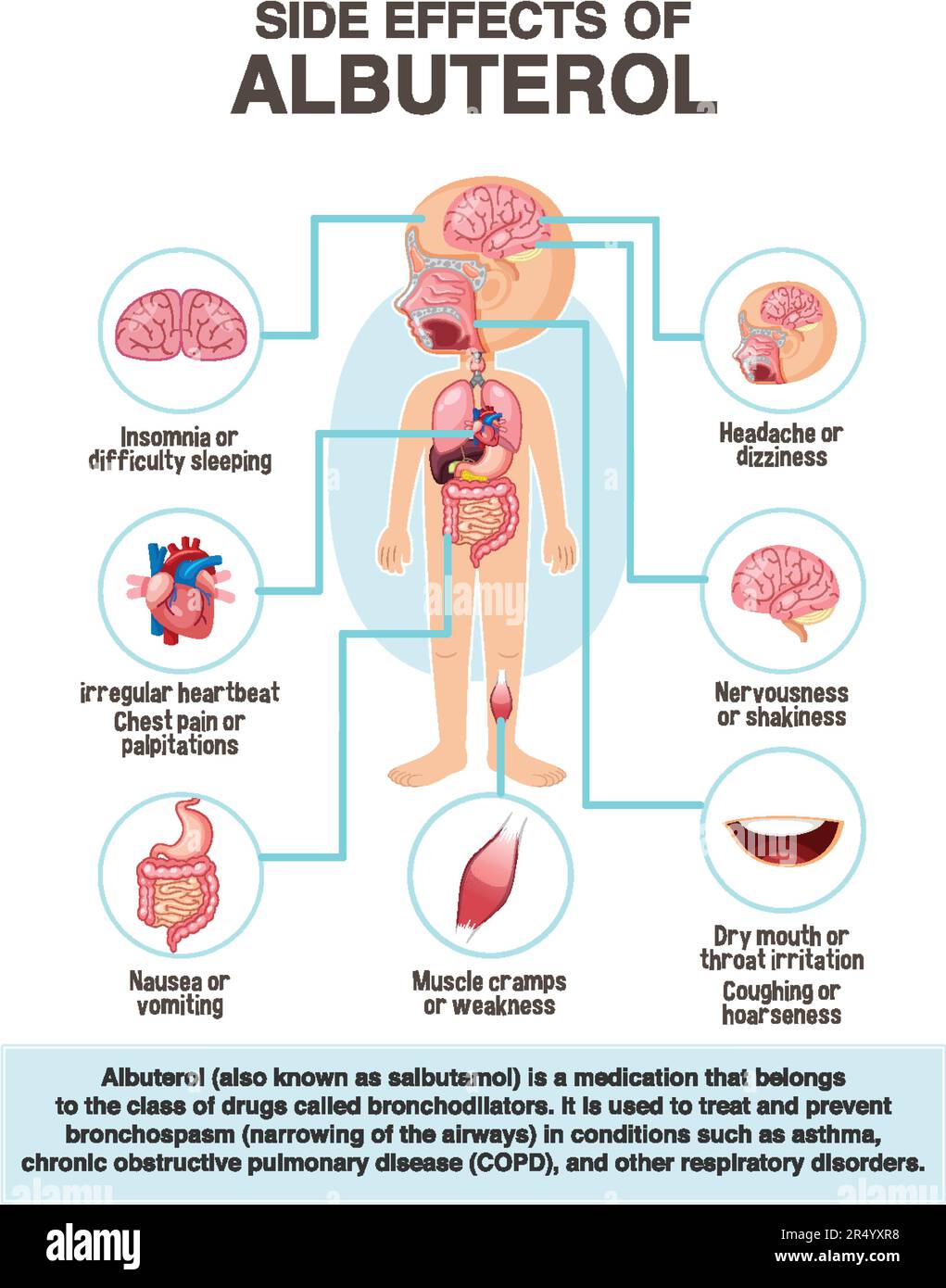 Human anatomy diagram cartoon style of albuterol side effects illustration Stock Vector