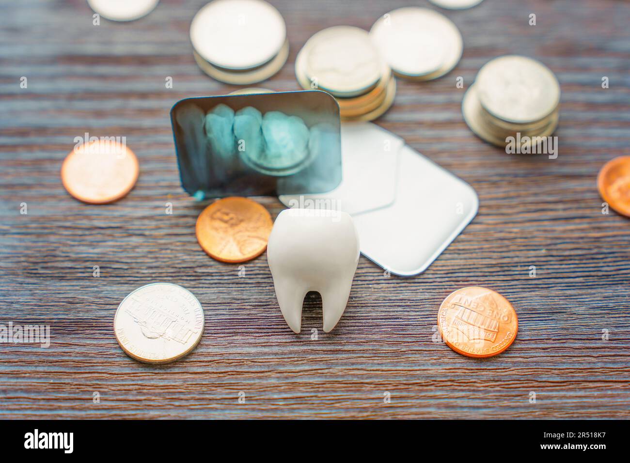 Dental concept with a model of a tooth, a teeth Xray film and