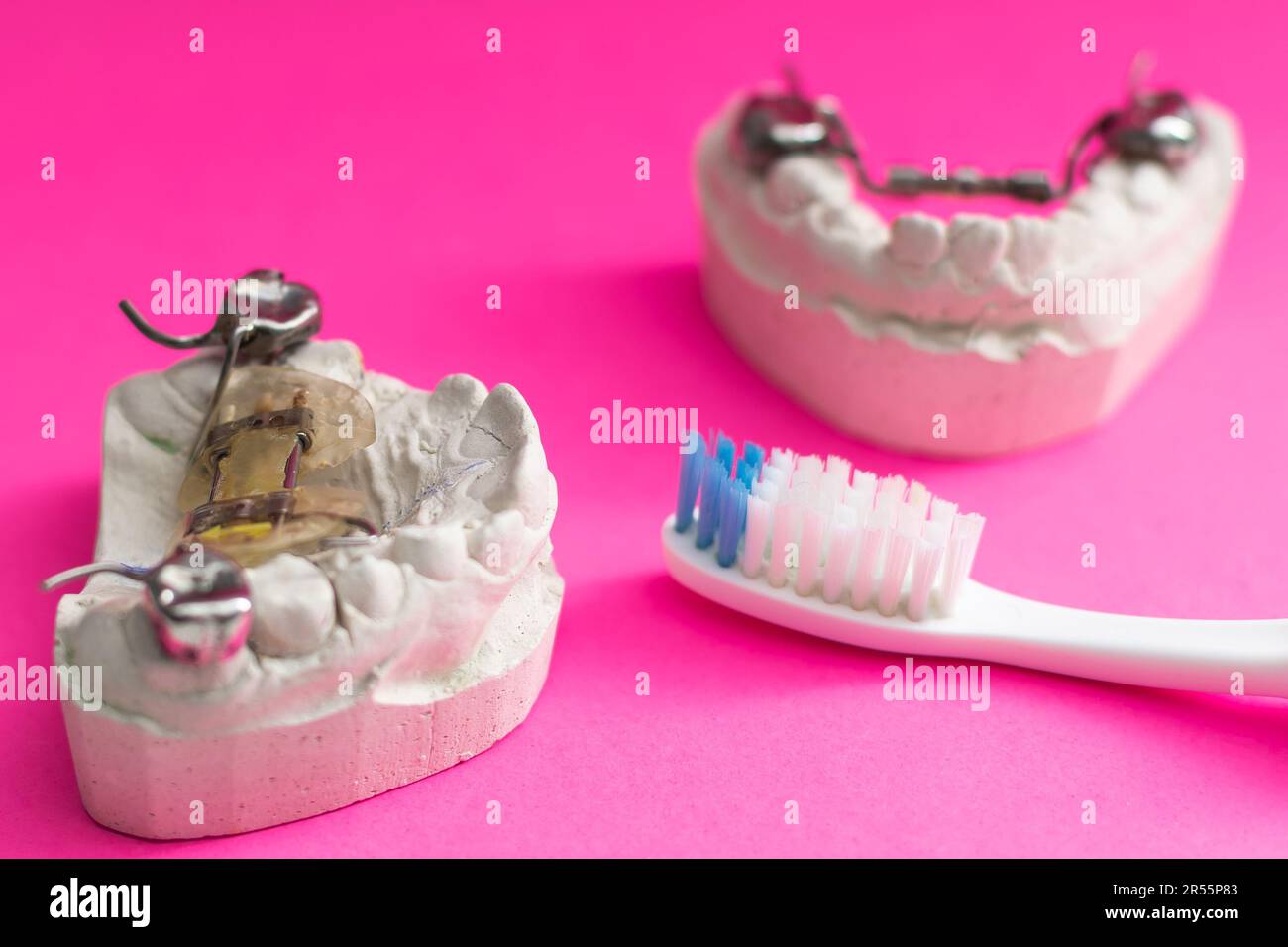 dental plate, plaster cast of child's jaw and toothbrush on blue