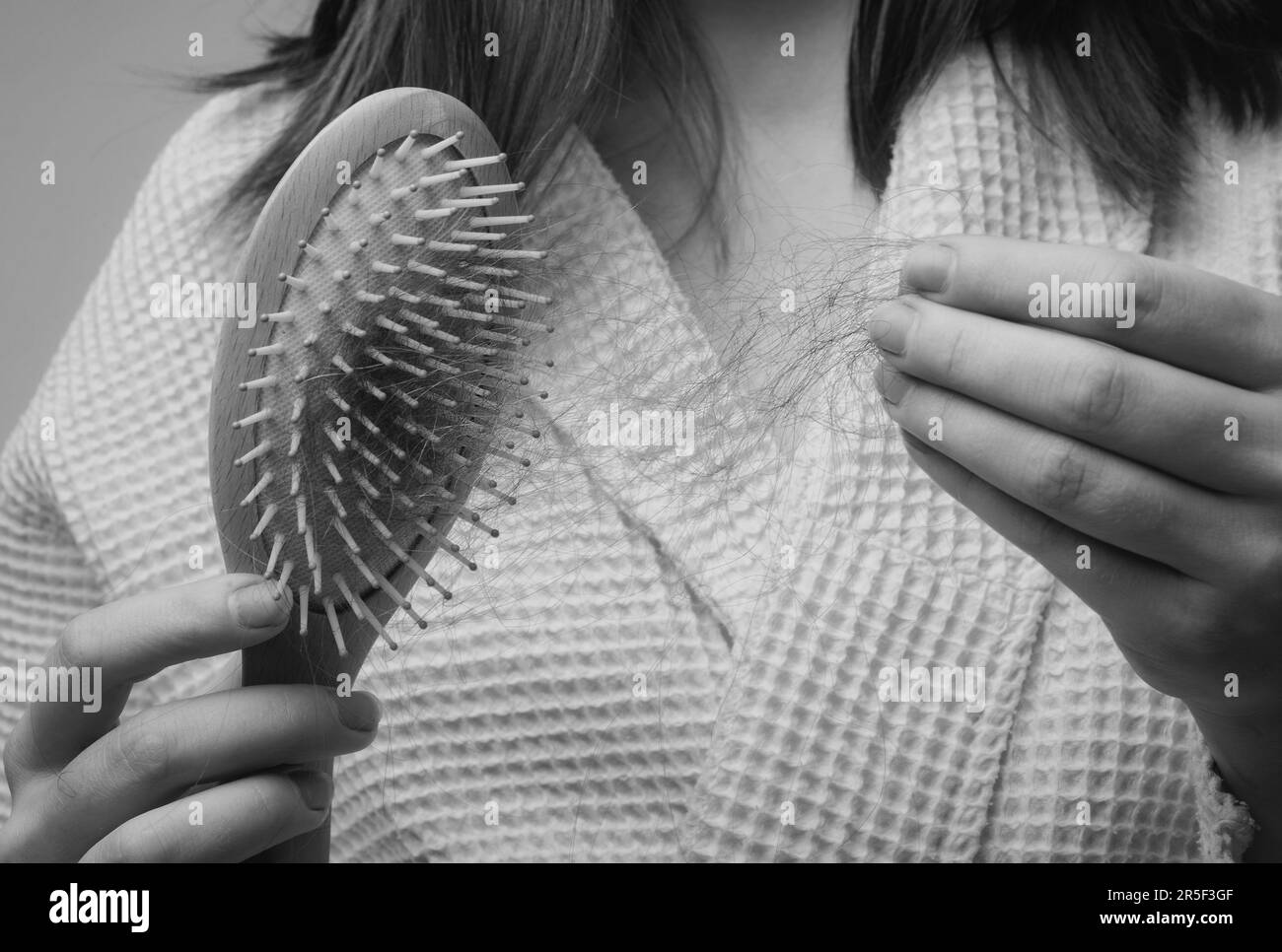 Concept of hair loss. Problem hair in comb, isolated. Damaged unhealthy