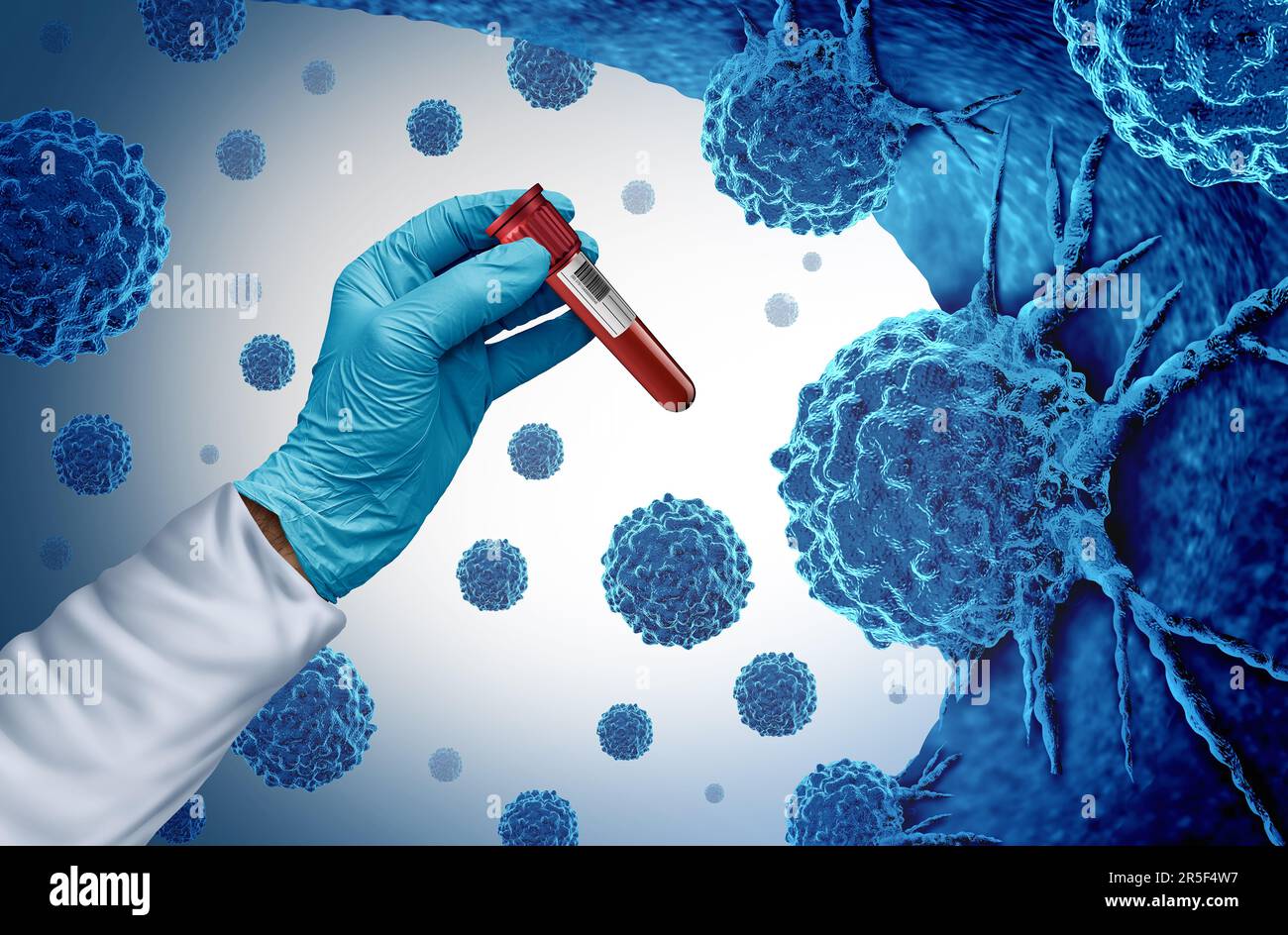 Multi Cancer blood test and screening for early detection of cancers and malignant cells as carcinogens and genetics with a cancerous cell Stock Photo