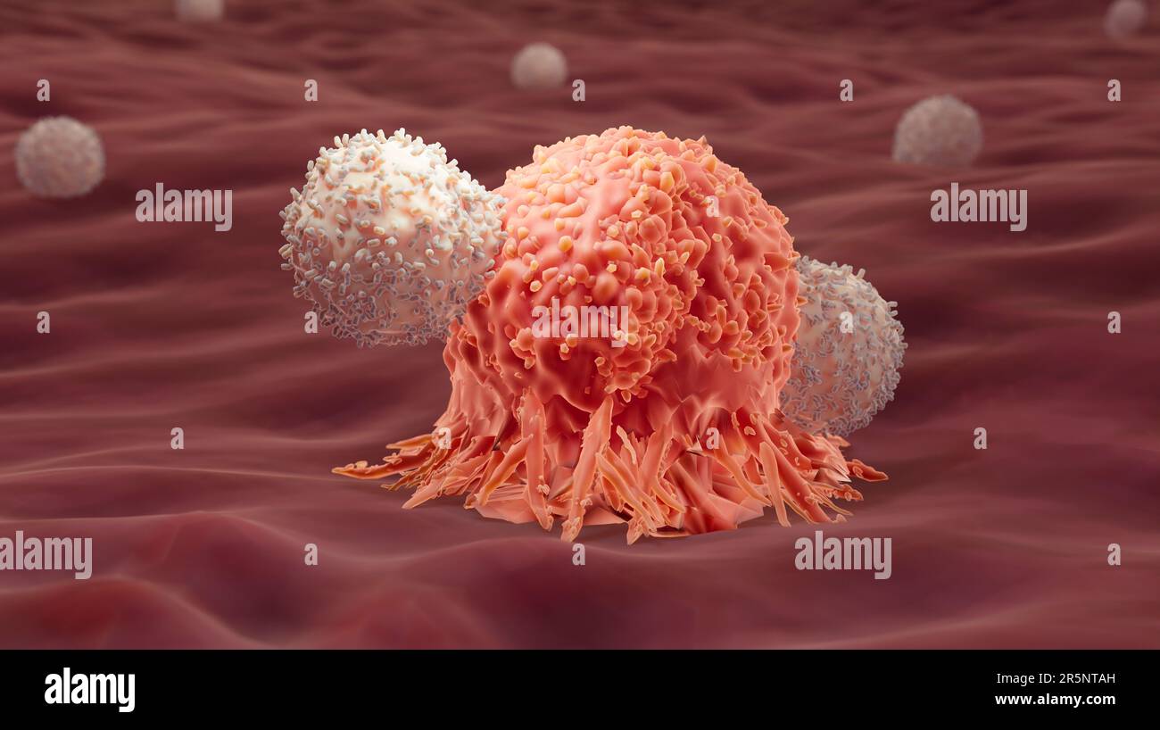 T-cells attacking a cancer cell, illustration Stock Photo - Alamy