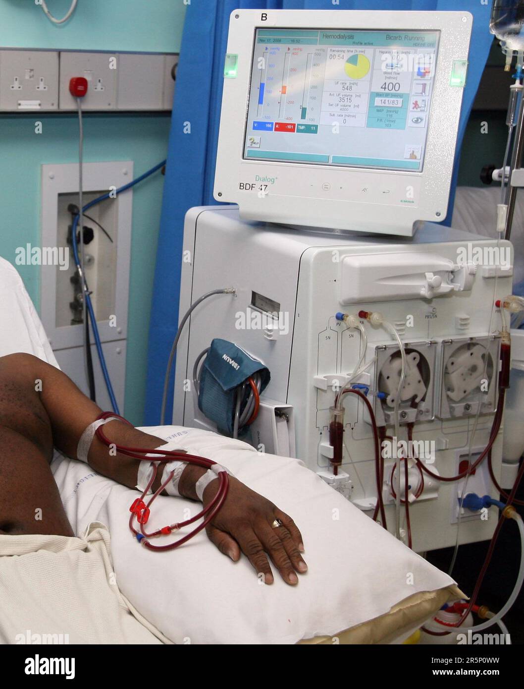 Kidney research uk hires stock photography and images Alamy