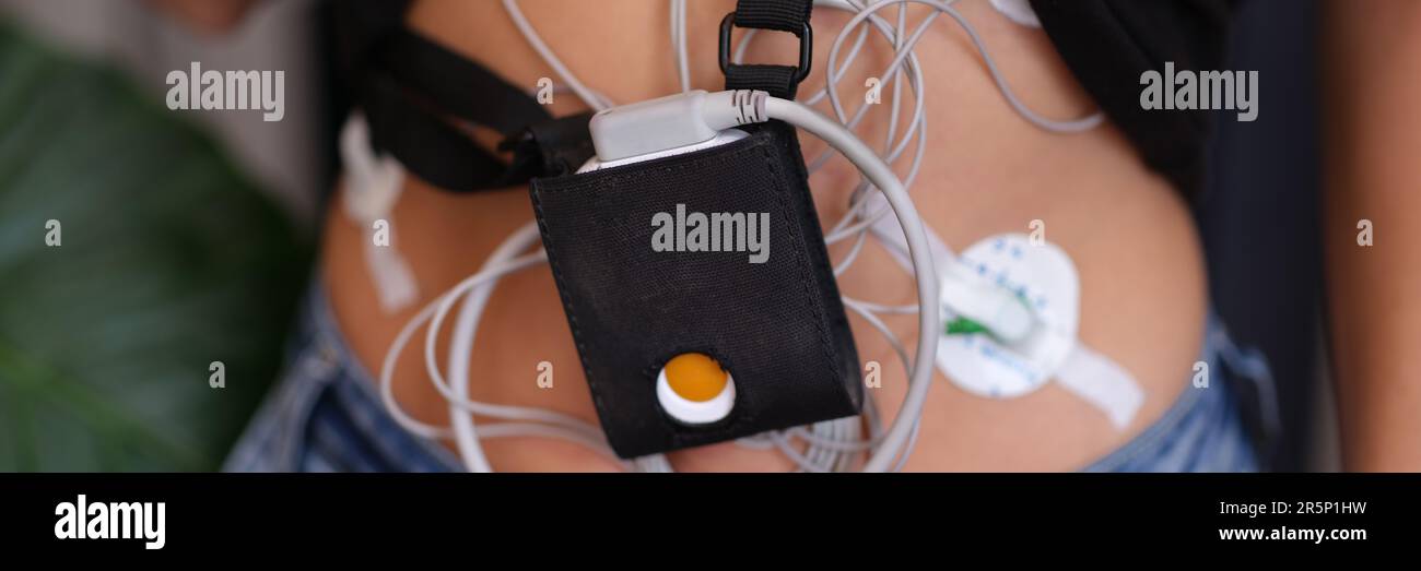 Ecg holter hi-res stock photography and images - Alamy