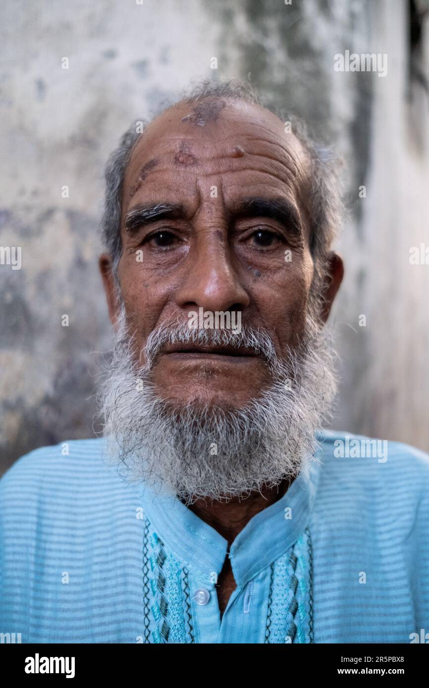Portrait Of A Bangladeshi Man Pratab Nagar Village Is Severely