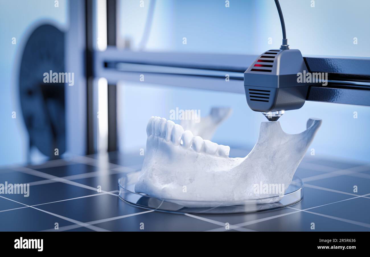 Printing a human jaw along with its teeth using 3D bioprinting - the ...