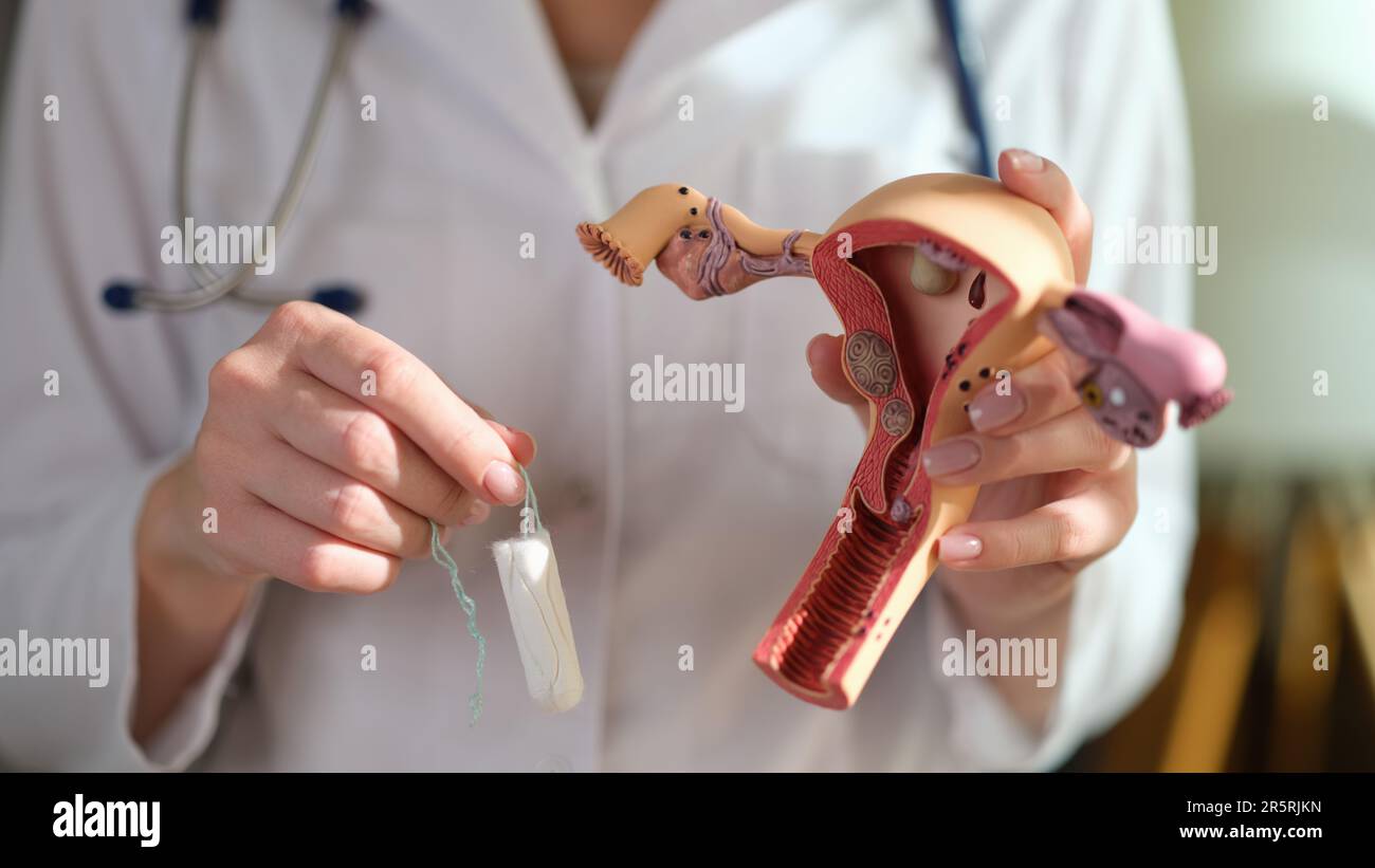 Gynecologist holds human uterus model and tampon in clinic Stock Photo ...