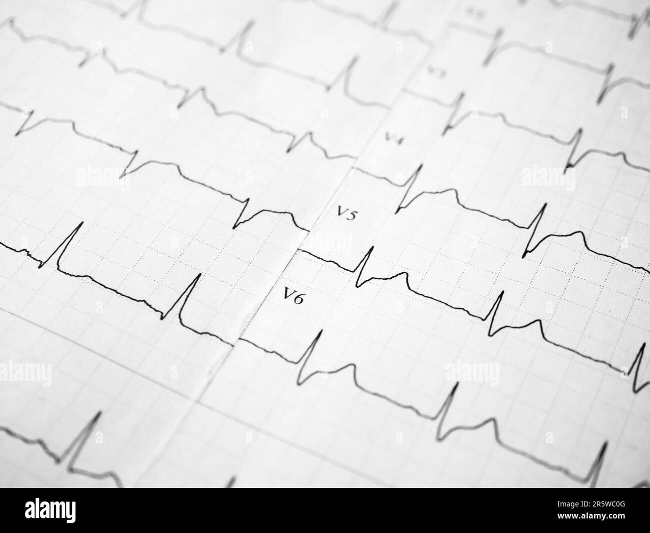 Close up of an electrocardiogram in paper form. ECG or EKG record paper. The heartbeat is shown on the graph. Medical and healthcare concept Stock Photo