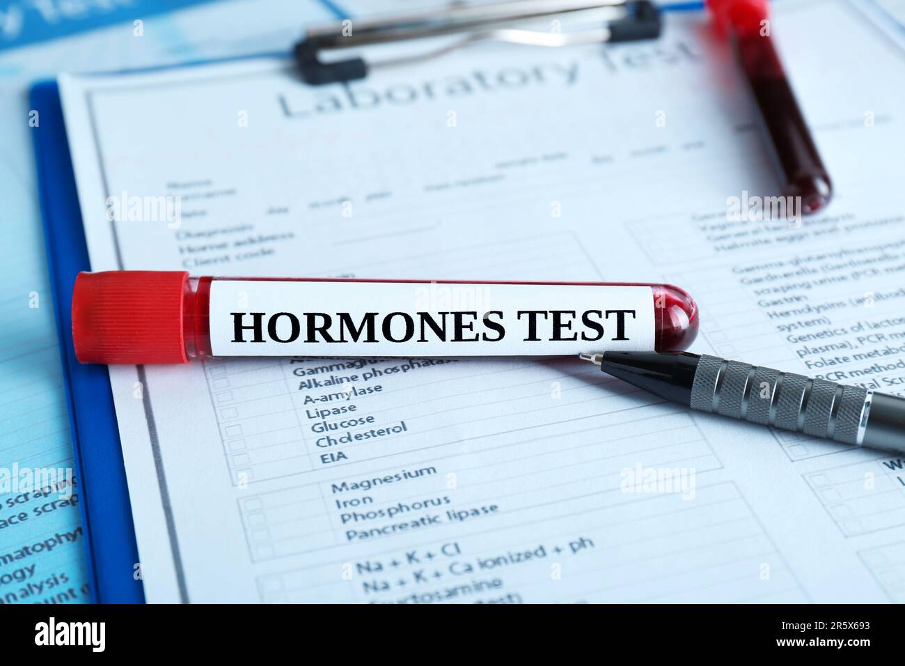 Hormones test. Sample tube with blood on laboratory form, closeup Stock