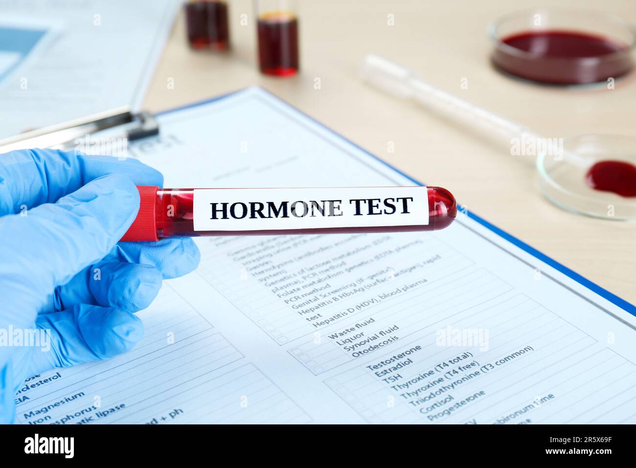 Hormones test. Scientist holding sample tube with blood against