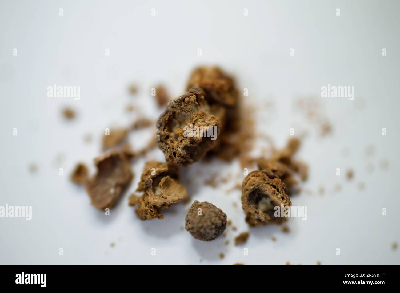 Nephrolithiasis, irregular brown kidney stones (renal calculus or nephrolith), the stones are different in size after operative ureteroscopy and Laser Stock Photo
