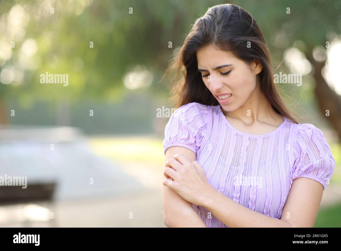 Woman scratching arm standing in a park in summer season Stock Photo