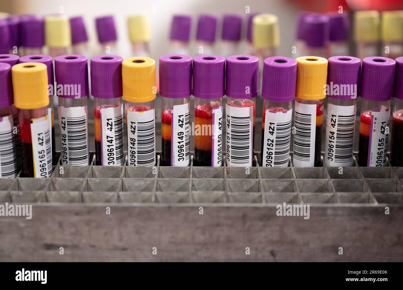 Munich, International. 07th June, 2023. Test tubes with blood samples
