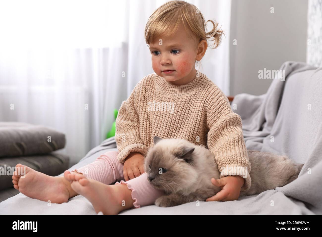 Cute little child with allergic redness sitting with adorable pet on