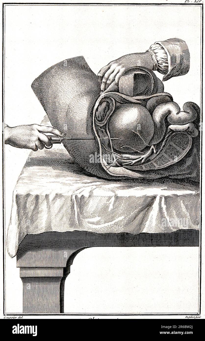 Medicine, anatomy, surgery, lateral section through the hypogastrium, c